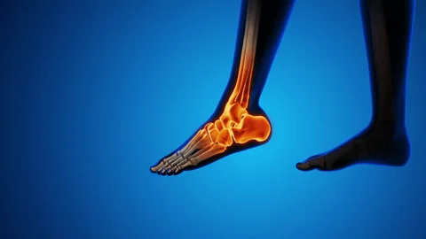 Can Total Knee Replacement affect diabetes